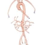 Abdominal III Model with Tortuous Splenic