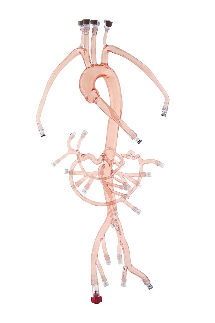 Abdominal III Model with Tortuous Splenic