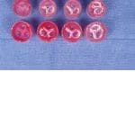 Healthy and calcified (light, med, heavy) aortic valves with annulus sizes: 20, 23, 26 and 29mm
