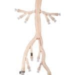 Arterial Silicone Vessel Iliac Model